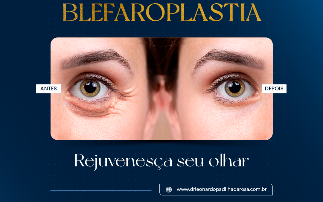 Blefaroplastia dr leonardo padilha, cirurgião plástico em campo grande/MS e Chapecó/SC 